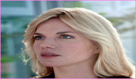 Is Eva Birthistle has a glass eye? Faked Reports Regarding Eye Surgery Have Appeared